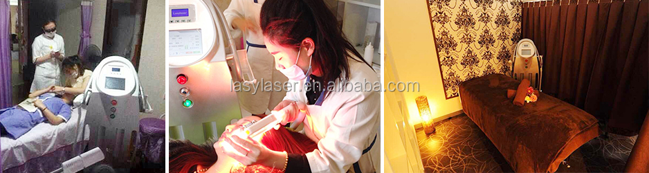 3 In 1 OPT picolaser Laser Tattoo Removal Machine Photon Therapy Equipment