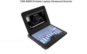  Digital Ultrasound Scanner Diagnostic System+6.5MHz Endo-Vaginal Probe Manufactures