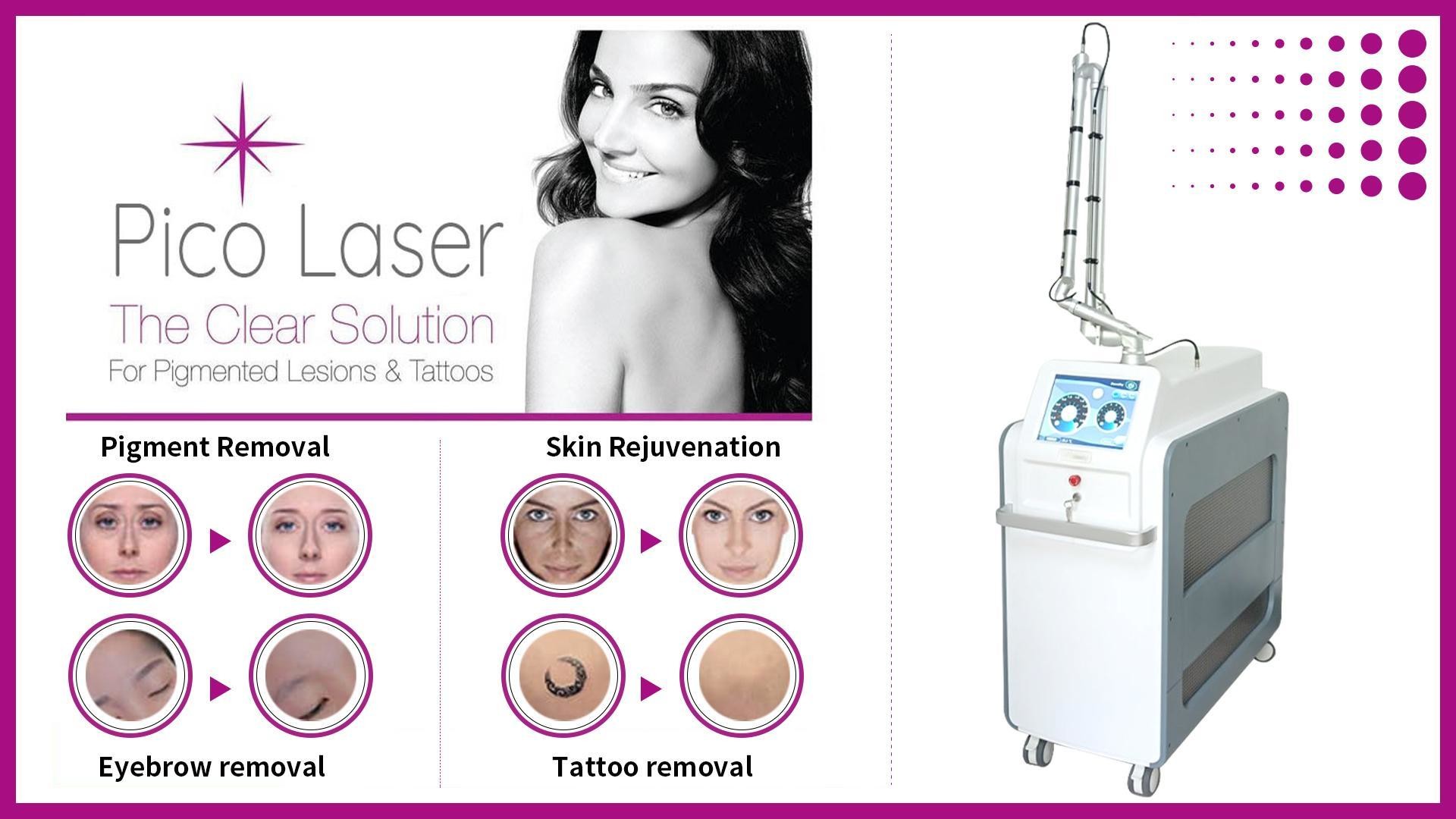 755nm Alexandrite picosecond Laser Tattoo Removal Machine