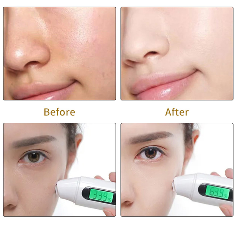 Organic Skin Care Acne Wrinkle Dark Spot Moisturizer Bleaching Turmeric Face Cream