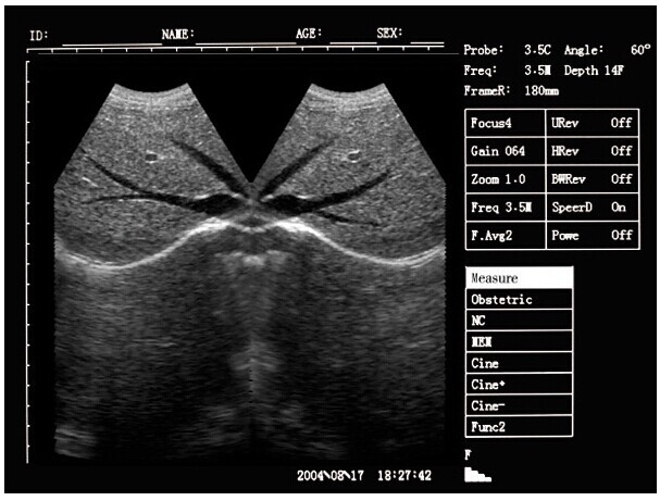 Portable ultrasound machine Laptop Ultrasound machine SU-7S with CE