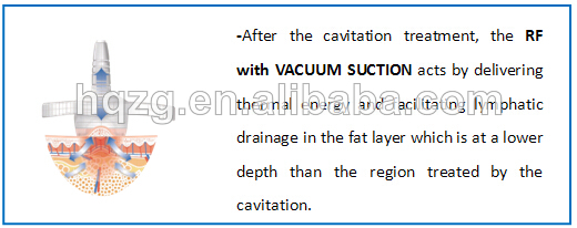 Ultrasonic RF Cavitation Slimming Machine
