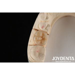 High Translucency Full Zirconia With Layers Biocompatibility And Flexural