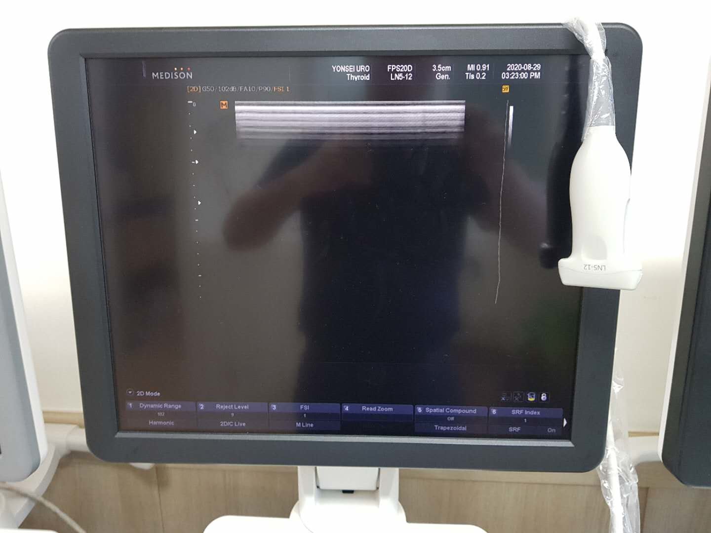Abdomen Convex Linear Ultrasonic Probe Samsung Medison LN5-12