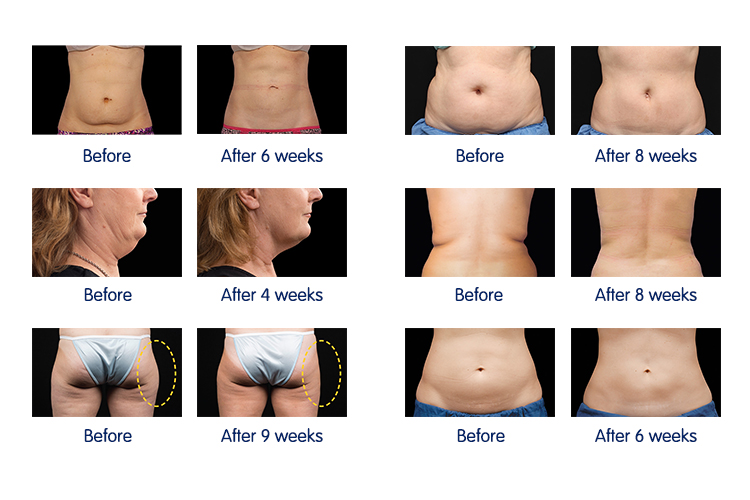 Treatment Before - After.jpg