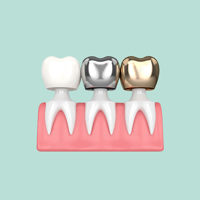 OEM Dental Crown Bridge Good Biocompatibility Smooth Surface Make Smile Sweeter