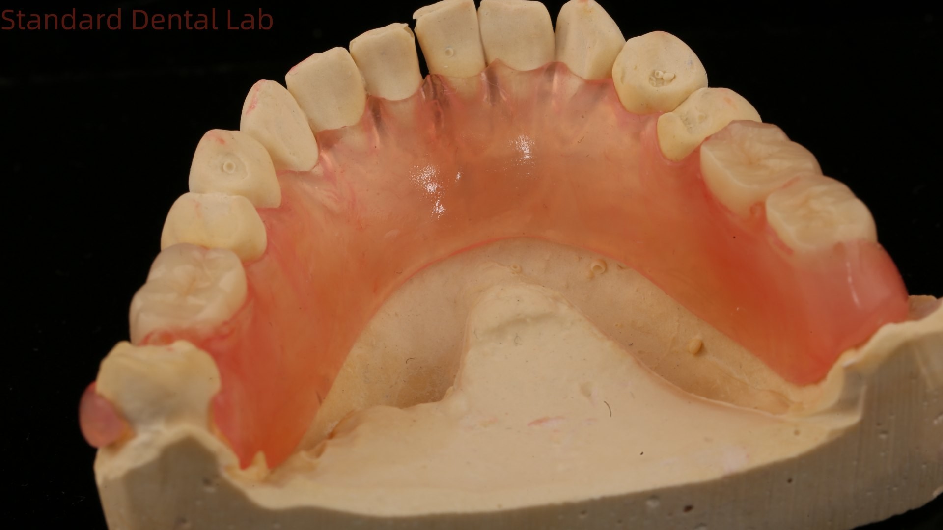 Dental TCS Valplast Flexible Partial Dentures Nesbit Valplast Finish China Dental Lab Valplast Clasp