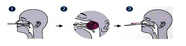 SARS-COV-2 World's Fastest Antigen Testing Kit - RESULTS IN 15 minutes!!! 3