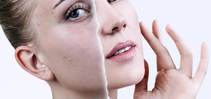 Skin brighter Meso Serum Microneedling Customized Logo Anti Aging Whitening Serum