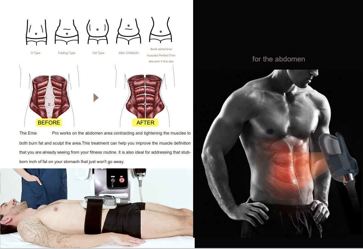 150HZ Frequency EMS Slimming Machine Professional For Enhanced Muscle Toning / Fat Burning