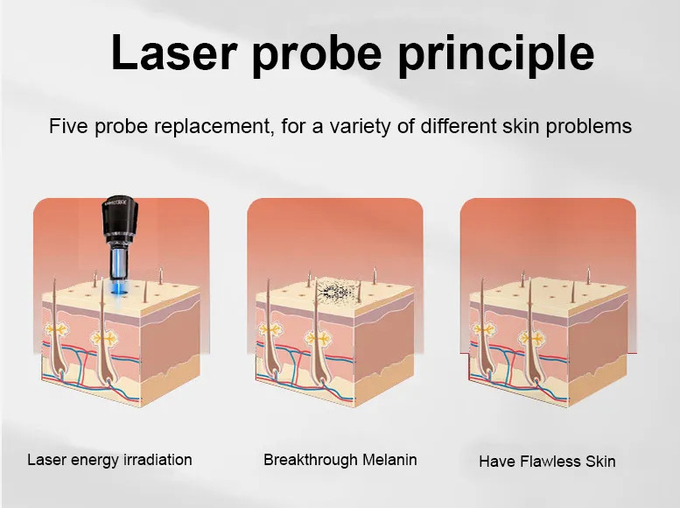 Q Switched ND Yag Laser Machine 1064nm 532nm For Removal Eye Wrinkles