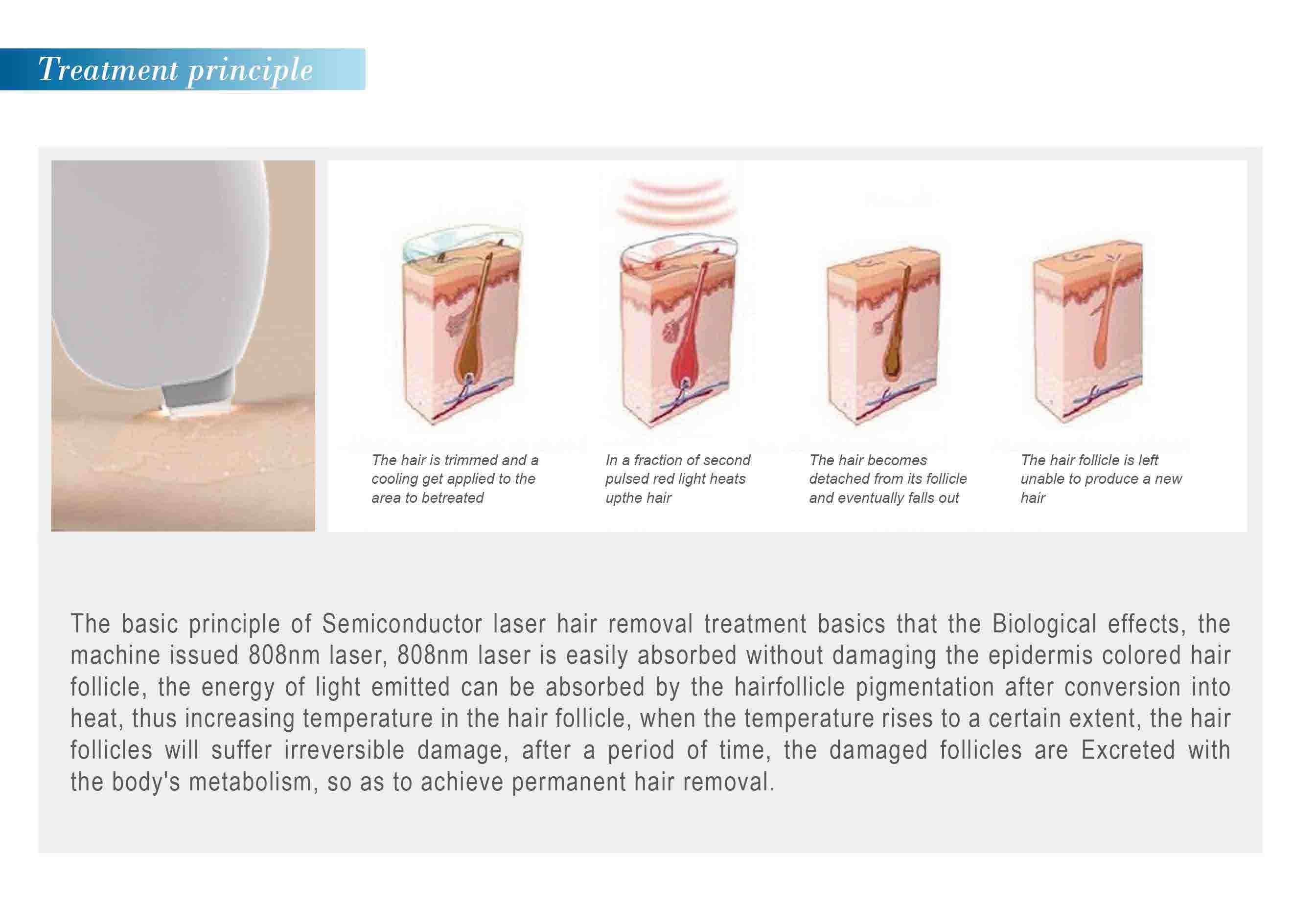 Salon equipment laser hair removal fda approved laser hair removal machine