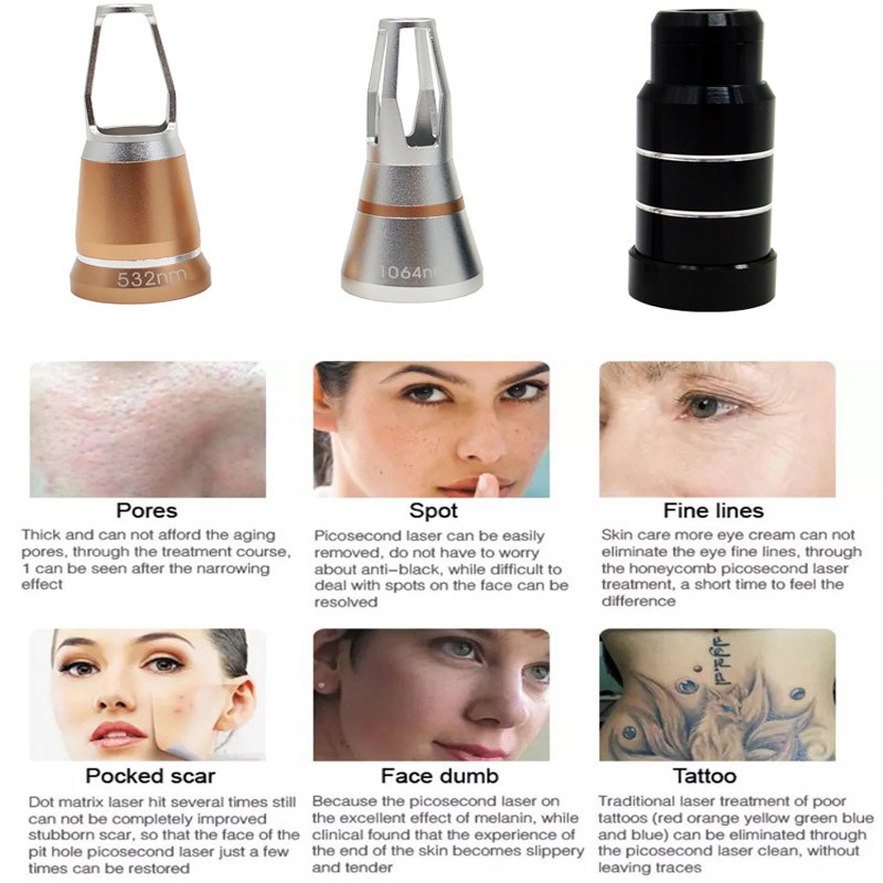 Q Switched Nd Yag Laser Tattoo Removal Machine Non - Invasive