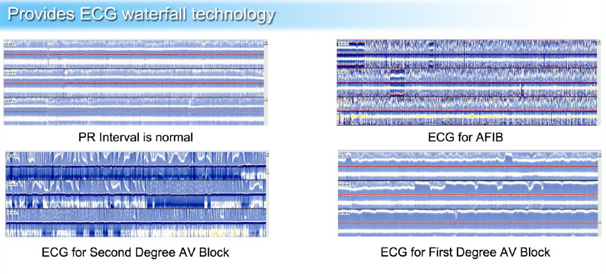 Holter ECG Workstation 99.9% Accuracy Holter ECG Analysis Software System