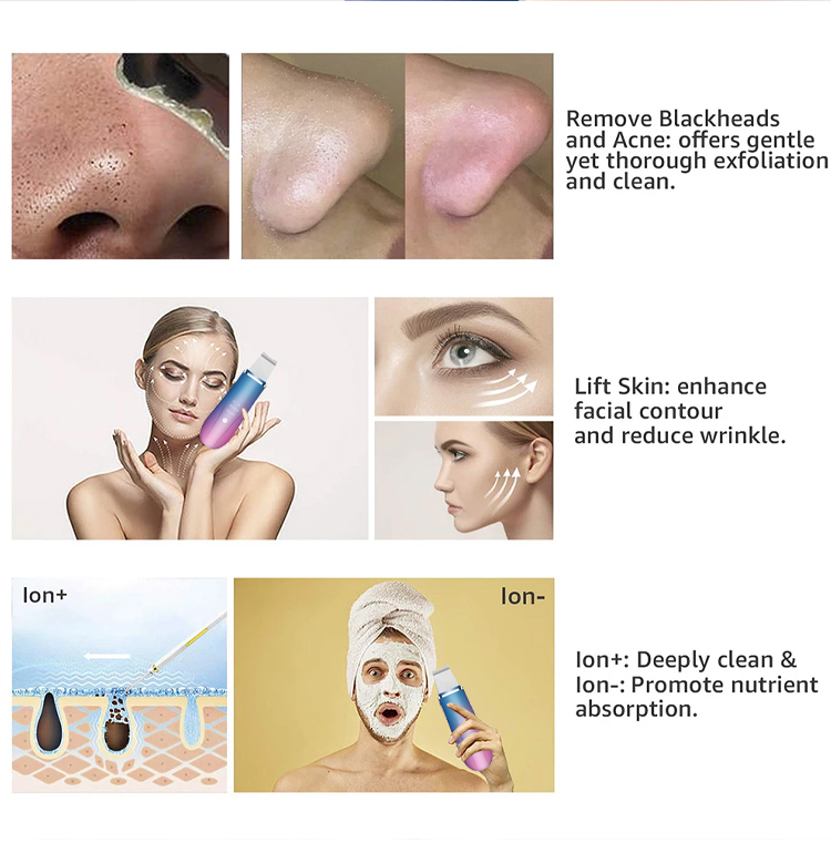 Wireless Ultrasonic Facial Spatula , Ion Cleaner Facial Skin Scrubber