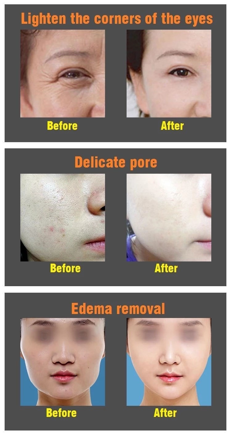 ROHS Skin Tightening 600mAh 15CM RF EMS Beauty Instrument