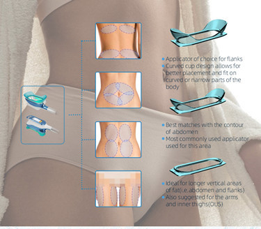 1500W Multifunctional Cool Slimming Machine fat loss