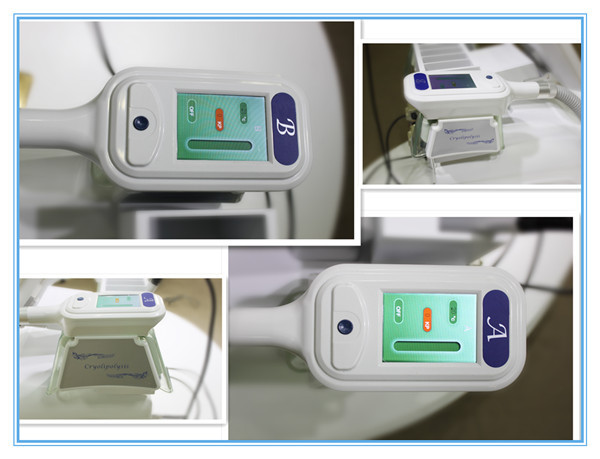 2018 professional cryolipolysis fat freezing machine home device fat freeze with CE&ISO