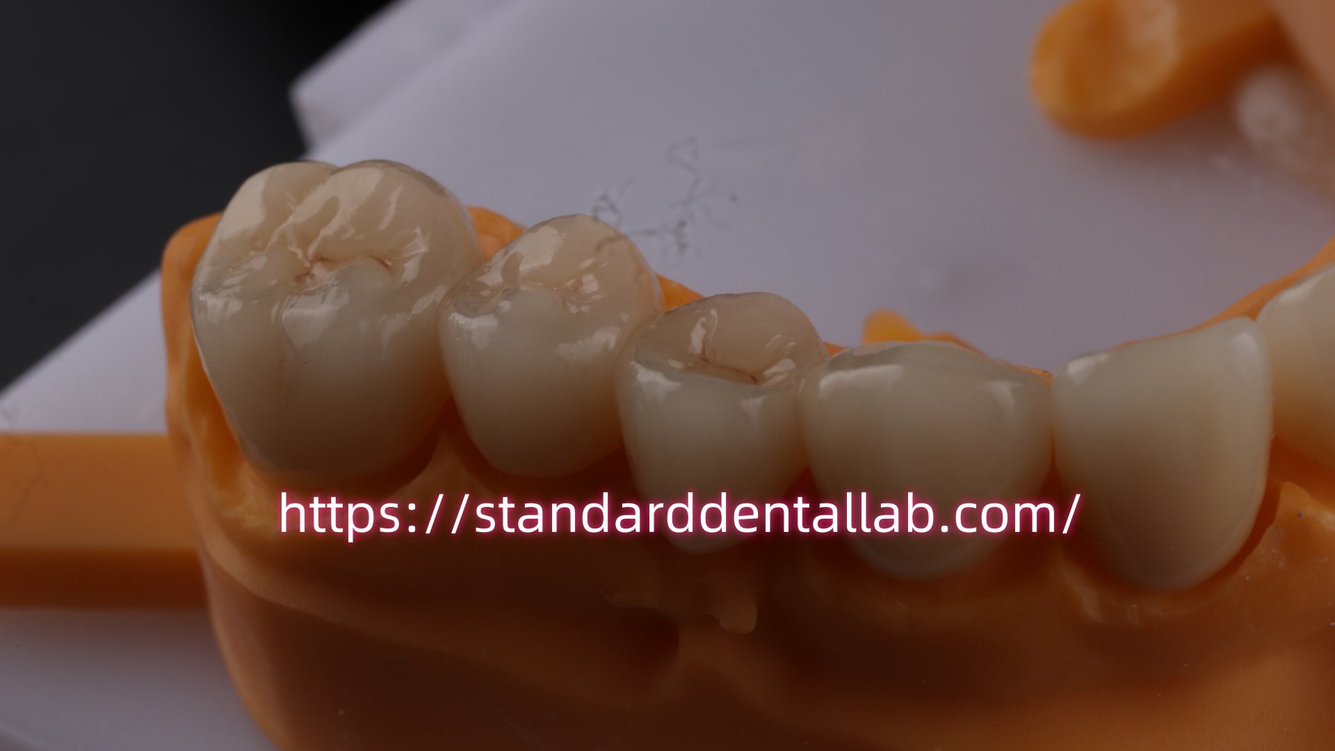 Layered Dental Zirconia Crown And Bridge Translucency 3D PRO Zirconia Porcelain Crown Standard Dental Lab