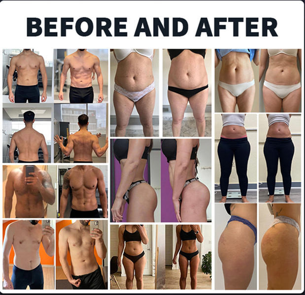 40K RF 6 In 1 Cavitation Machine With Lipo Laser Body Slimming