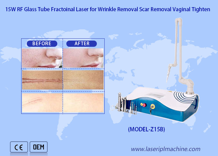 10600nm Veterinary Co2 Laser Wart Removal Surgical 15w Device For Dogs