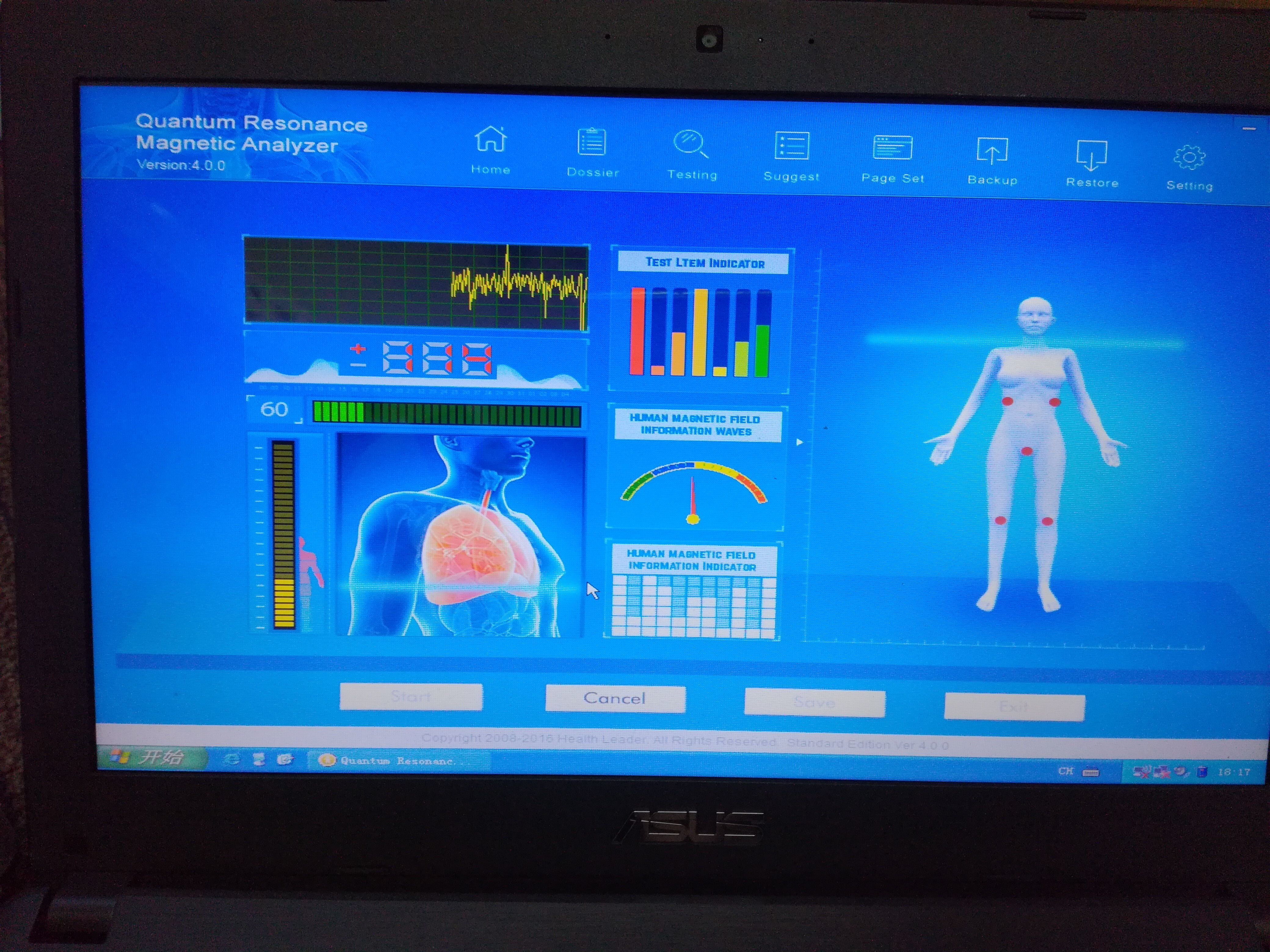 French Quantum Body Health Analyzer