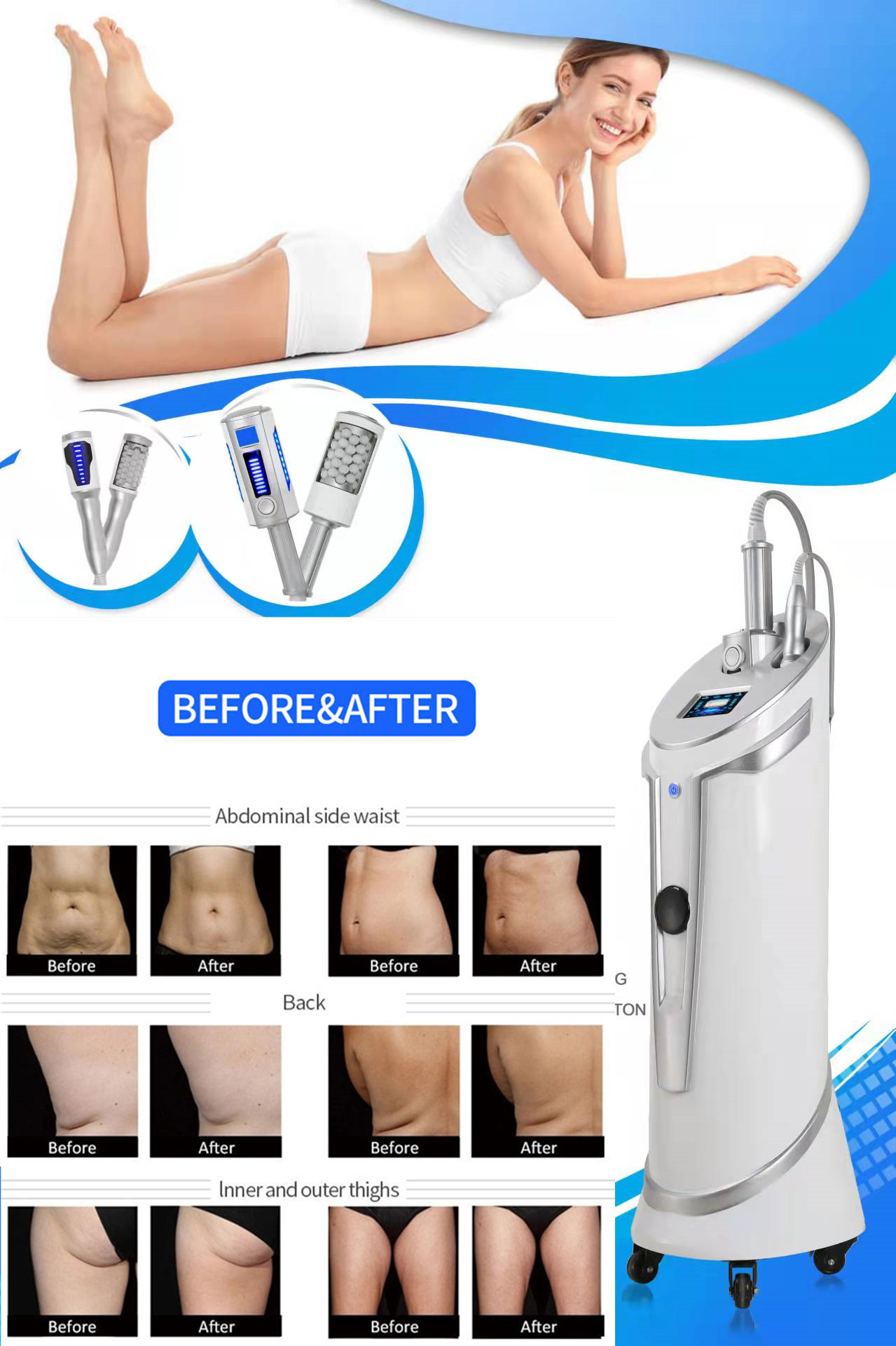 Inner Ball Roller Body Slim Device Cellulite Cavitation Machine OEM