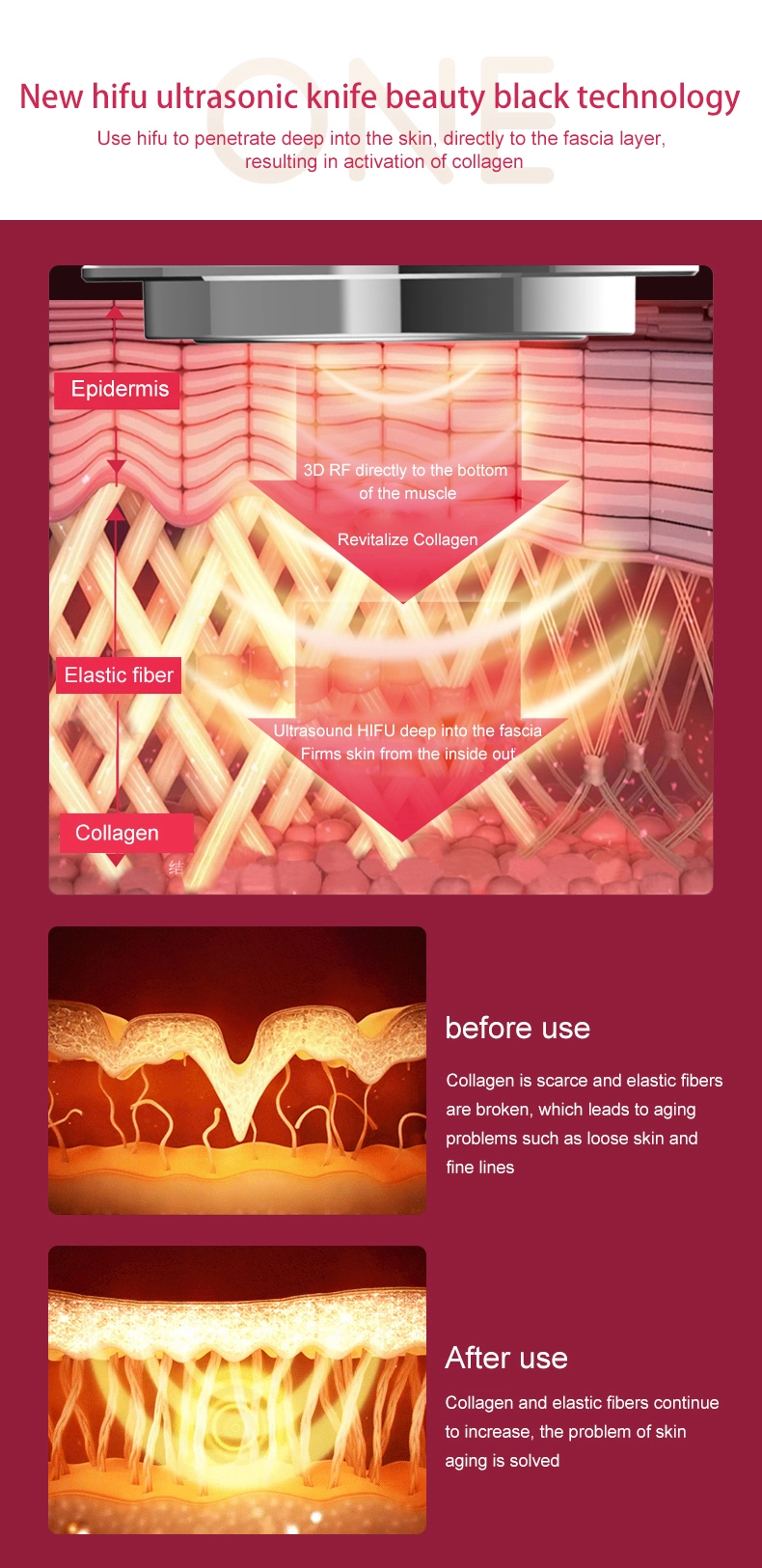 Elegant home use skin care with RF LED HIUF lon ems Muscle Stimulator Face Lift machine