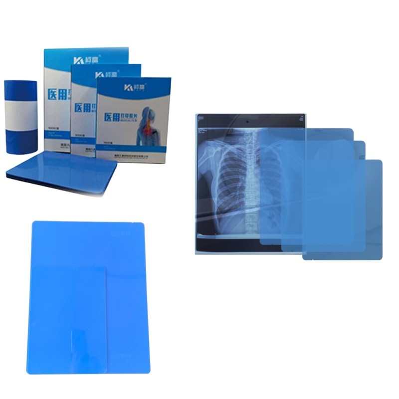 Medical X-Ray/CT/DR Dry Scan Film For X-Ray Laser Image Printer And Thermal Image Printer Equipment