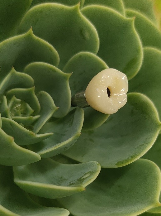 Cemented Implants Crowns Bridges