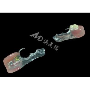 Customized Cast Partial Dentures Precision Metal Framework For Optimal Fit And