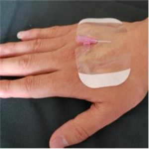 5*6cm Waterproof Transparent Dressing Sterile Adhesive Pads For Wounds
