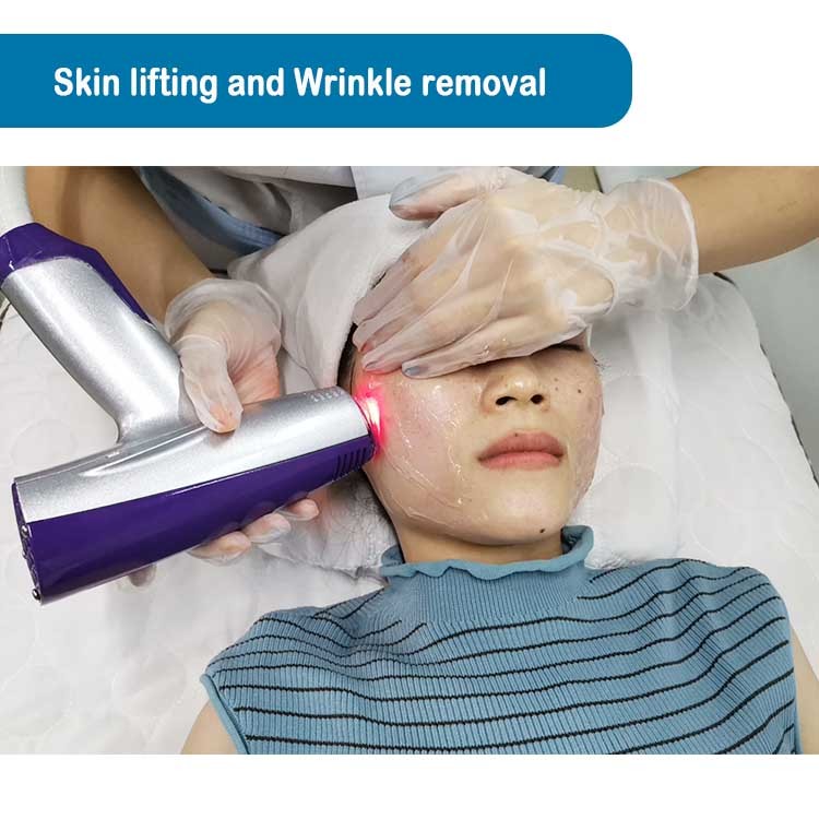 Microneedling RF Fractional Radio Frequency Beauty Equipment Facelift Skin Tight