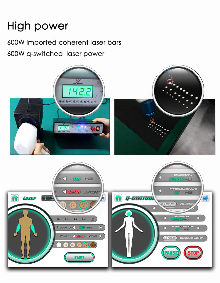 Portable Q Switched 532nm Soprano Ice Laser Machine