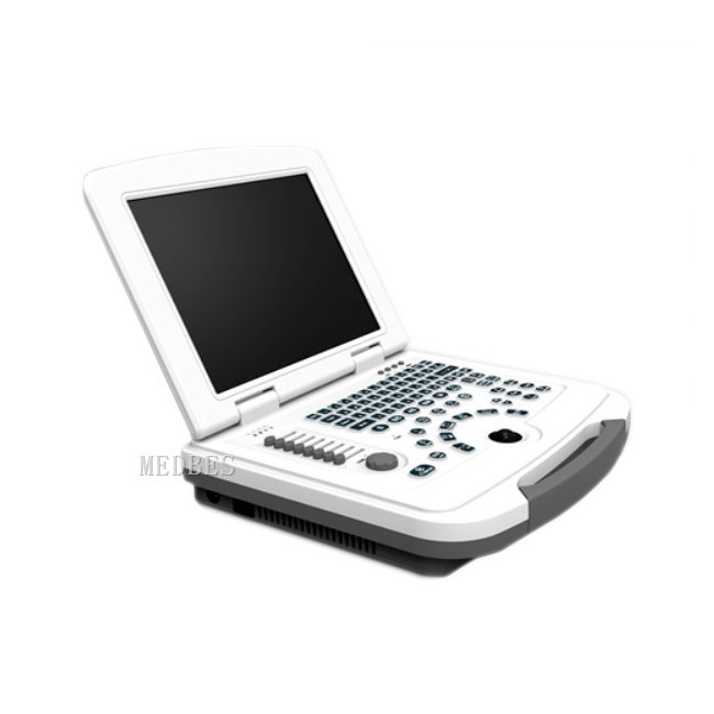 Hospital 15 TFT Color Medical Portable Ultrasound Machine