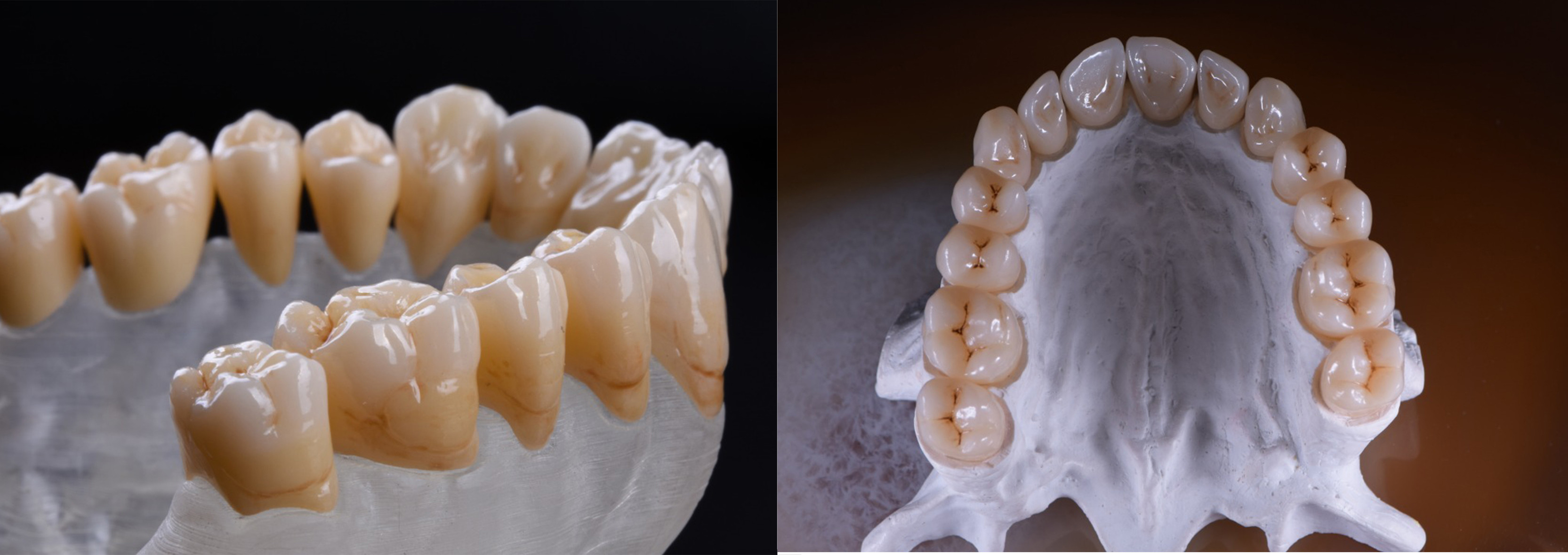98x10mm White 1200MPA Dental Zirconia Blank For Lab