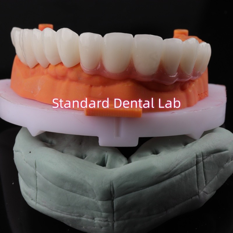 Good Fitting Precise Esthetic Zirconia Porcelain Crown Pink Porcelian With Bleaching Shade